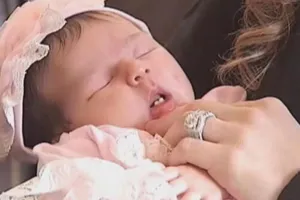 Cô bé mới sinh có 2 răng cửa 