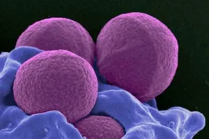 Số người chết vì siêu vi khuẩn sẽ vượt ung thư