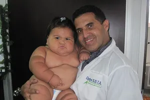 Bé 10 tháng tuổi nặng 20kg 