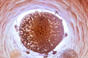 'Xóa sổ' thành công virus HIV khỏi tế bào con người?