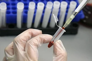 Phải giải thích cho người bệnh khi làm xét nghiệm đắt tiền