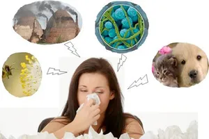 Viêm mũi dị ứng: Bệnh gây nhiều phiền toái