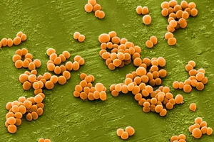 Vụ hàng trăm công nhân ngộ độc ở Trà Vinh: Do thức ăn nhiễm tụ cầu vàng