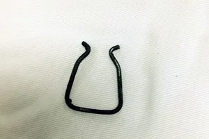 Mổ nội soi lấy kẹp giấy trong lồng ngực bé 26 tháng tuổi