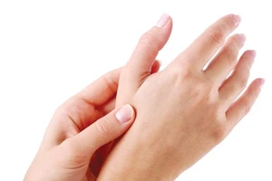 Hội chứng ống cổ tay và cách điều trị