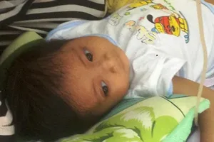 Bí ẩn 'người lùn đầu chim' ở Bệnh viện Nhi Đồng 1