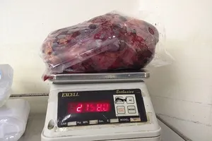 Cắt bỏ quả thận nặng gần 3 kg