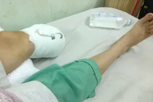 Cô gái trẻ mất một chân khi qua đường 