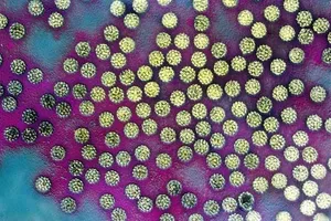 4 căn bệnh truyền nhiễm bạn không thể ngờ tới