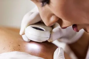 Các nguyên nhân khó ngờ gây bệnh cho da