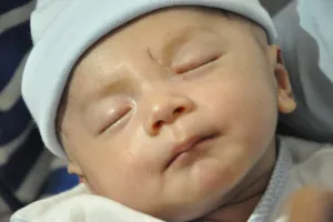 Chùm ảnh bé bị dao đâm vào đầu bụ bẫm trong ngày tái khám