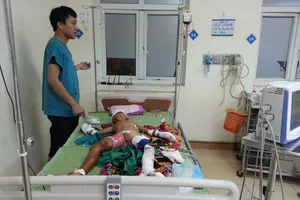 Vật lạ phát nổ, bé trai dập nát tay chân