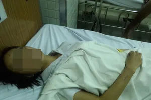 2 nữ sinh bị tạt acid, một người bỏng nặng