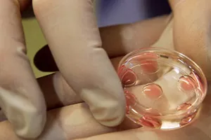 Điều kiện tham gia chương trình thụ tinh ống nghiệm miễn phí