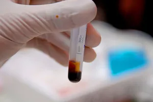 Xét nghiệm DNA ở đâu, chi phí bao nhiêu?