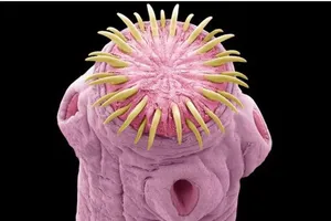 Suýt chết vì sán dây… làm ổ trong não