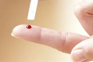 Xử trí khi có người ngất xỉu đột ngột