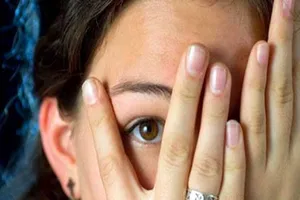 Cơ thể mọc nhiều lông, bệnh gì?