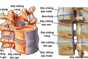 Đau tê từ bụng xuống chân coi chừng bị hẹp ống sống ngực