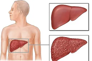 Các thuốc gây độc cho gan