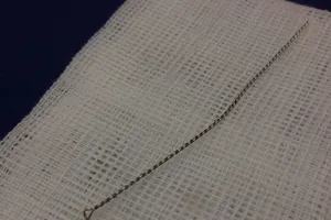 Hi hữu nhân viên lấy ráy tai xong phải đưa khách đi nhập viện