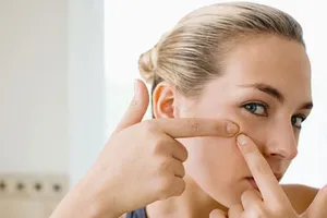 Điểm mặt 6 nguyên nhân làm bạn nổi mụn