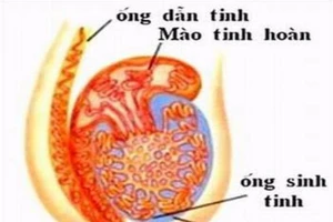 Viêm mào tinh hoàn nguy hiểm như thế nào?