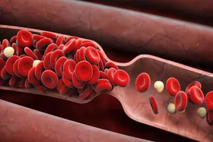 6 dấu hiệu bị tắc nghẽn mạch máu