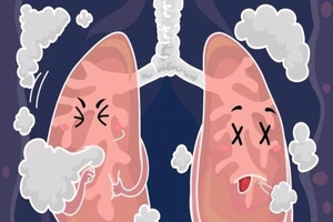8 dấu hiệu cảnh báo phổi có vấn đề