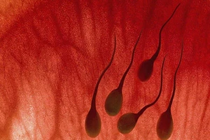 Xuất tinh ra máu, bệnh gì?