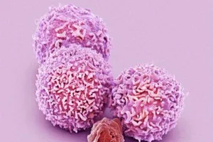 Tế bào ung thư di căn trong cơ thể như thế nào