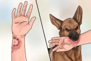 Chữa chó cắn bằng lá cây, bé trai thiệt mạng