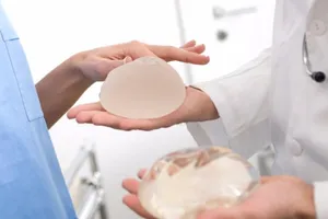 Cảnh báo thêm 1 dạng ung thư nguy hiểm do nâng ngực