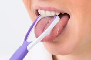 Giật mình trước 5 tác hại khi quên vệ sinh lưỡi
