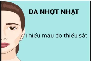 Dấu hiệu trên khuôn mặt cảnh báo sức khỏe có vấn đề