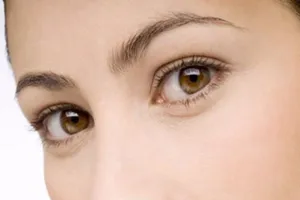 Dấu hiệu bất thường ở mắt cảnh báo cơ thể có vấn đề