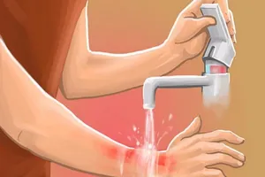 Cẩm nang xử trí cấp cứu các tai nạn thường gặp