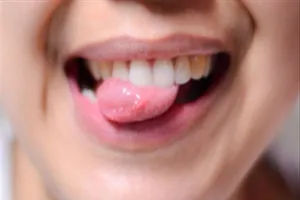 Kiểm tra lưỡi để biết bạn đang mắc bệnh gì