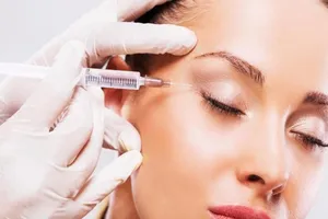 Bị mù vì tiêm chất làm đầy mặt ​