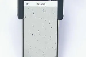 Tự kiểm tra chất lượng tinh trùng bằng smartphone