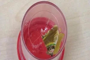 Tưởng bị viêm ruột 6 năm, hóa ra...