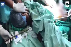 Cứu sống công nhân bị thanh thép đâm xuyên người