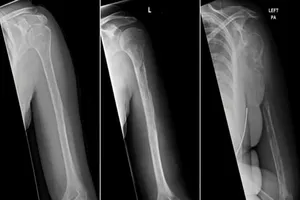 Người phụ nữ mắc bệnh cực hiếm, thế giới chỉ có 64 ca