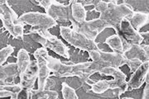 Tử vong do nhiễm vi khuẩn 'ăn thịt người' sau kỳ nghỉ