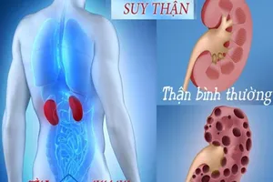 Dấu hiệu nhận biết suy thận