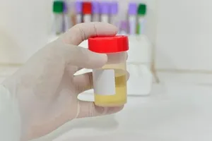 4 dấu hiệu mách bạn có vấn đề bàng quang