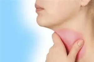 Thuốc gì trị viêm họng đỏ cấp?