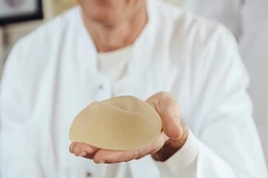 Thêm cảnh báo nguy hiểm về miếng độn ngực silicone