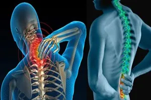 Hướng dẫn tư thế đúng cho người bị bệnh cột sống