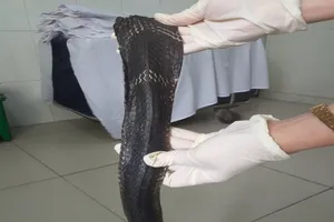 Thêm một người nguy kịch do bắt rắn hổ mang chúa